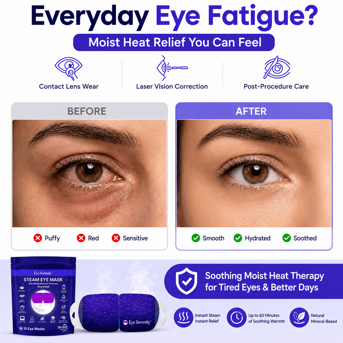 Eye Serenity Steam Eye Mask - Self-Heating Warm Eye Compress